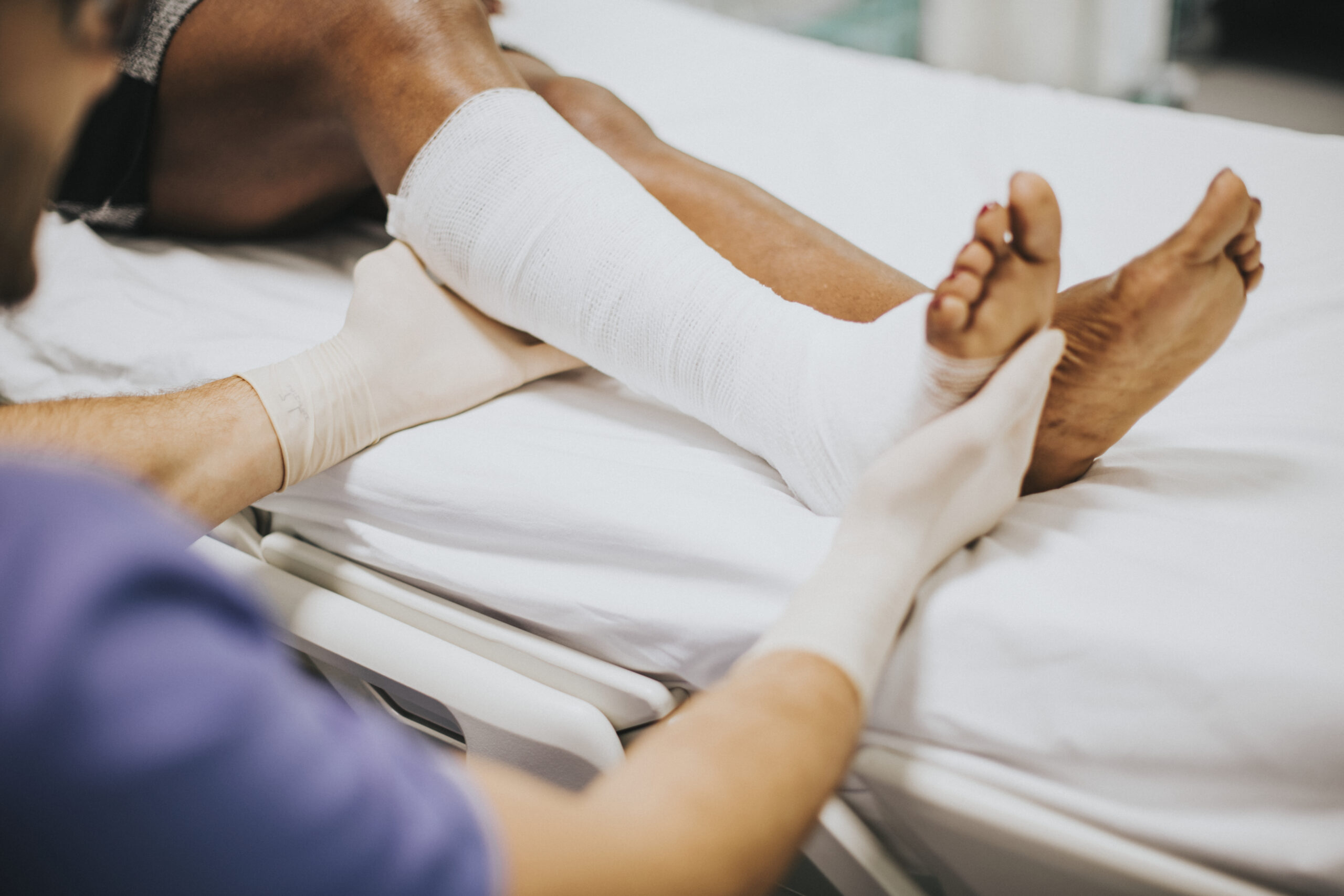 Fracture treatment by one of the most sports injury doctor in kolkata, India