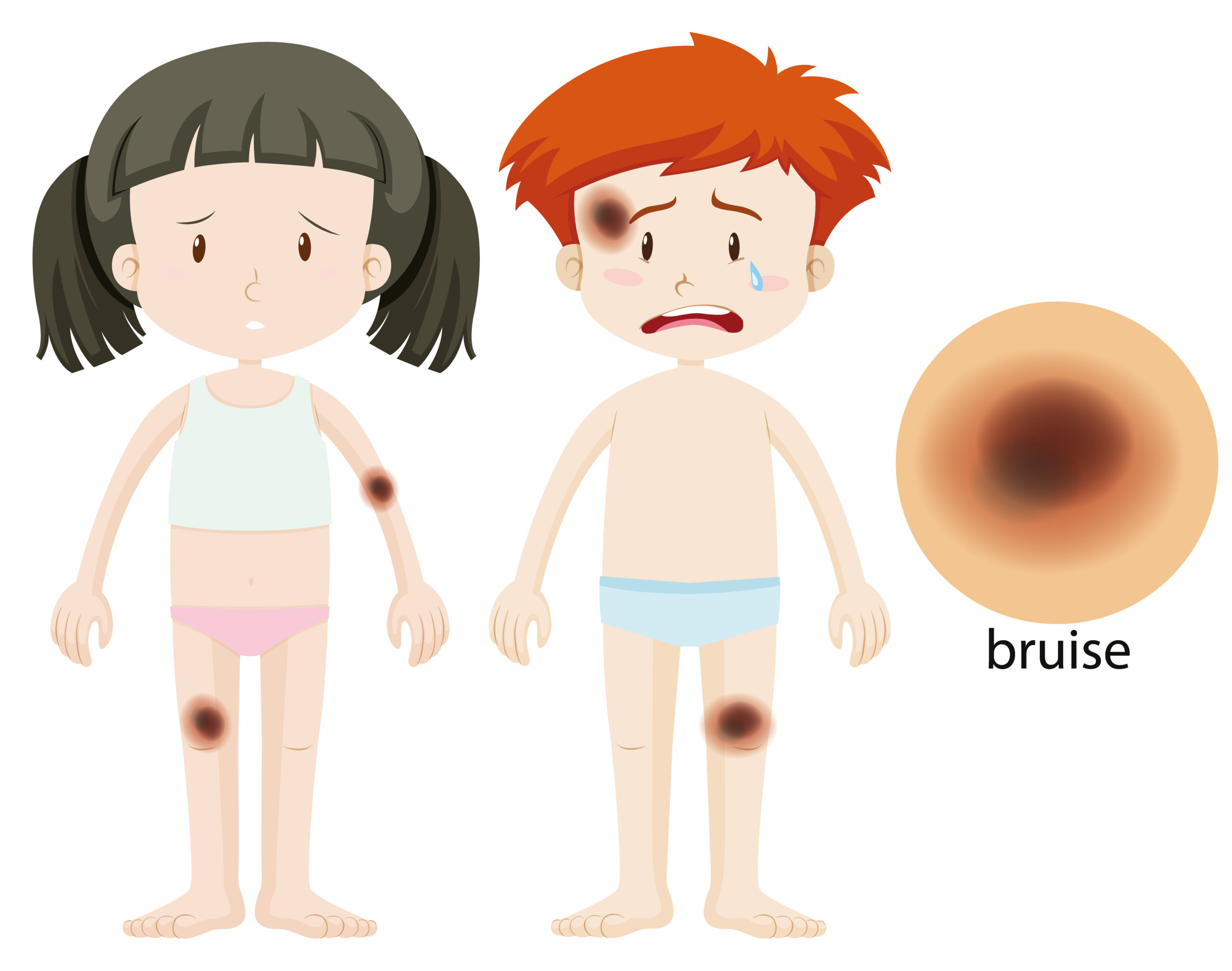 contusions | pulmonary contusion treatment in kolkata